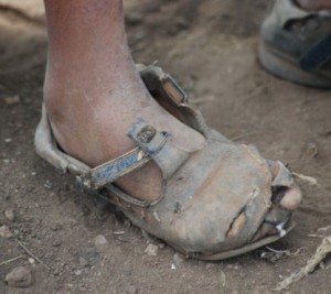 worn-out shoe